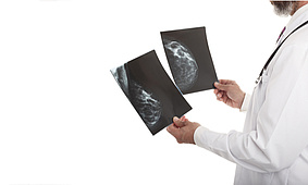Arzt betrachtet Mammografie. Bild: shutterstock/ Lana_M